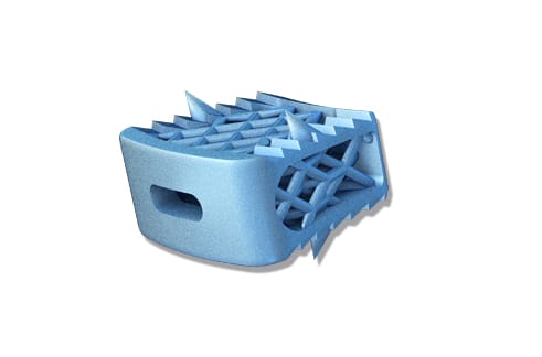 3D-Ti-Klatka-międzykręgowa-szyjna